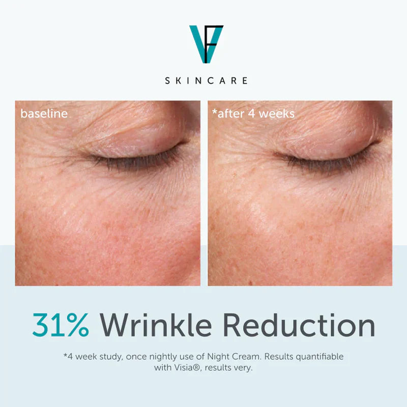 Night Retinol Cream